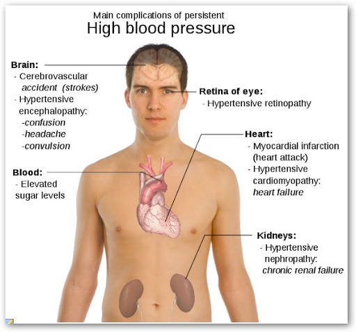 Questions And Answers On High Bp Umuaka Times